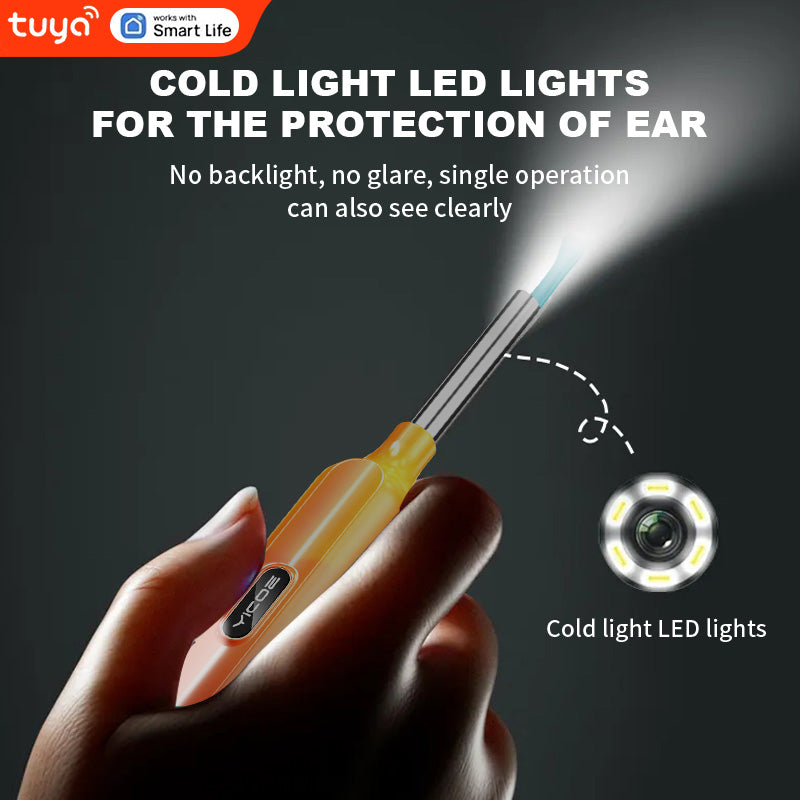 Tuya-Smart Ear Cleaner ✨ 1296P HD Camera + 6 LED Lights 💡 APP Control & Voice Commands 🌟 Real-Time Ear Rescue for iPhone/Android 🔥 #SmartHomeHacks #OddlySatisfying Tuya-Smart Ear Cleaner ✨ 1296P HD Camera + 6 LED Lights 💡 APP Control & Voice Commands 🌟 Real-Time Ear Rescue for iPhone/Android 🔥 #SmartHomeHacks #OddlySatisfying